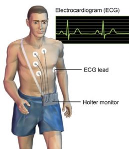 24 Hour Holter Monitor - North Side Cardiology